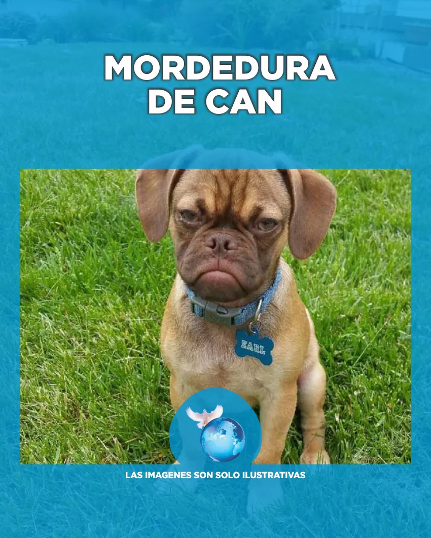 MORDEDURA DE CAN